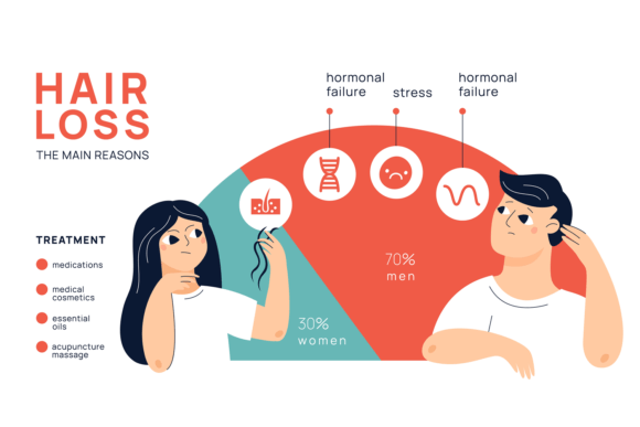 Download Hair Loss Infographic. Male and Female a - Premium Bundle