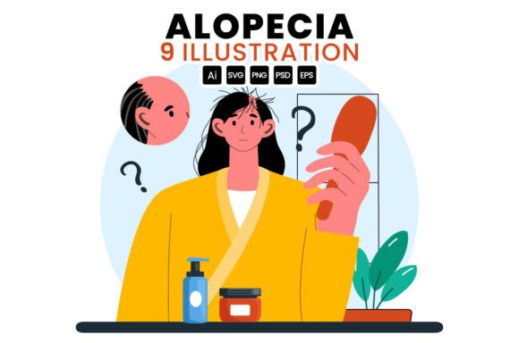 Download 9 Alopecia Hair Loss Illustration - Premium Resources